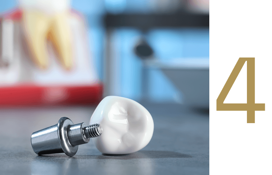 Dental implant components including an abutment and a custom-made dental crown, symbolizing the final stages of the dental implant procedure at Advanced Implant & Cosmetic Dentistry.